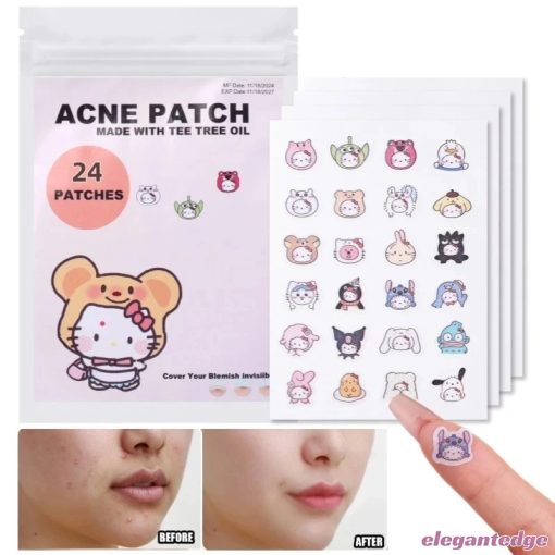 💟Elegant💟Dán Mụn Hoạt Hình Sanrio HelloKitty Hình Mụn Miếng Dán Vô Hình Mụn Loại Bỏ Mụn Miếng Dán Chăm Sóc Da Mới - Ảnh 3