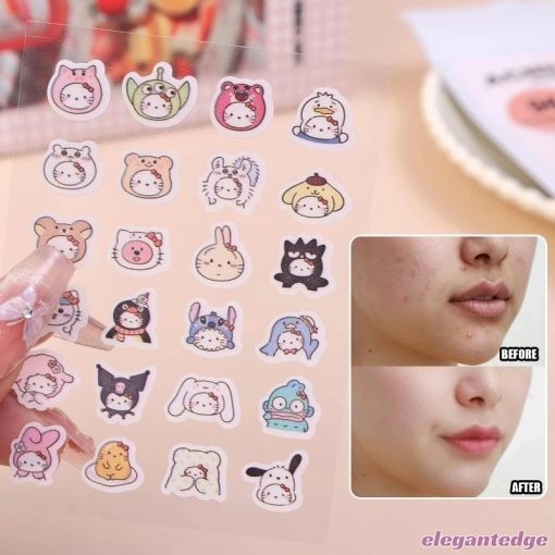 💟Elegant💟Dán Mụn Hoạt Hình Sanrio HelloKitty Hình Mụn Miếng Dán Vô Hình Mụn Loại Bỏ Mụn Miếng Dán Chăm Sóc Da Mới - Ảnh 4