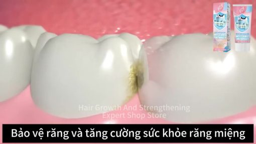 【BÁN CHẠY】Kem đánh răng phục hồi sâu răng Loại bỏ sâu răng, giảm đau và phục hồi răng bình thường