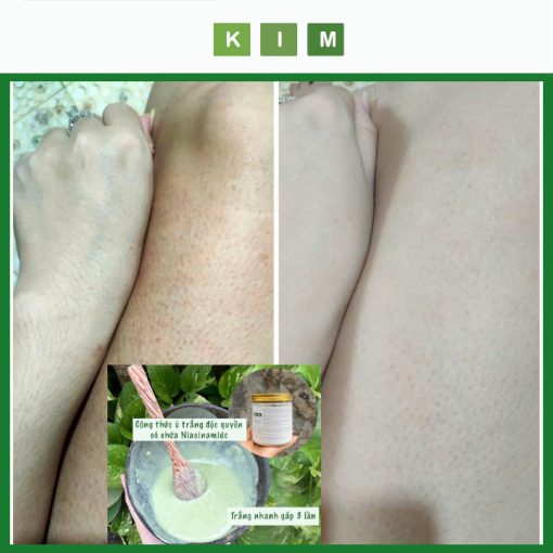 Bột ủ trắng Niacinamide độc quyền Spa tắm trắng thuần chay homemade Kim - Thuần Thiên Nhiên trắng da dưỡng da nâng tone - Ảnh 4