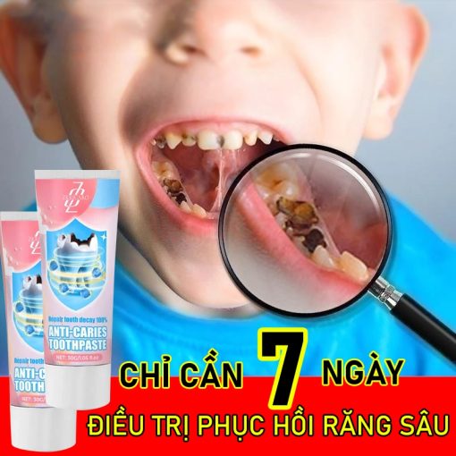 【BÁN CHẠY】Kem đánh răng phục hồi sâu răng Loại bỏ sâu răng, giảm đau và phục hồi răng bình thường - Ảnh 2